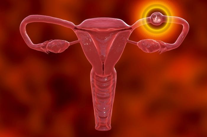 Is Sacrohysteropexy a Safe Option for Uterine Prolapse?